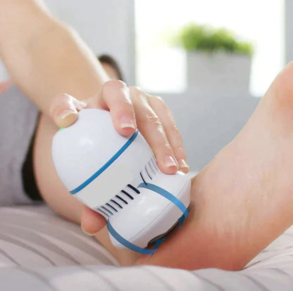 Radiance  Vacuum Callus Remover